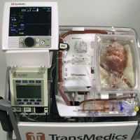 Doctors Revive and Transplant Hearts That Have Already Stopped Beating